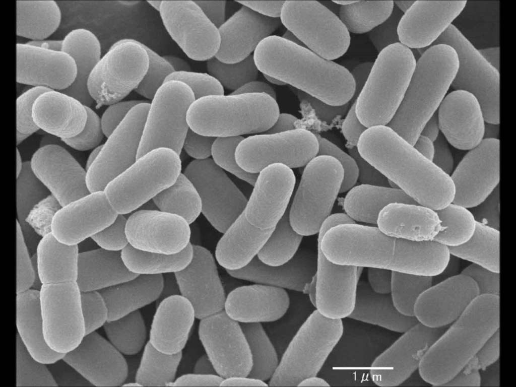 potential bacterial therapy for&nbsp;ASD