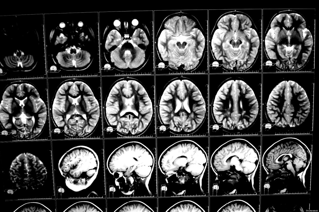 discovering the roles of zinc and B12 in neurodevelopment